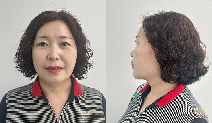 หลังทำหัตถการ