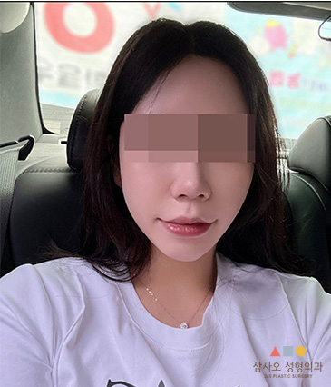หลังทำหัตถการ