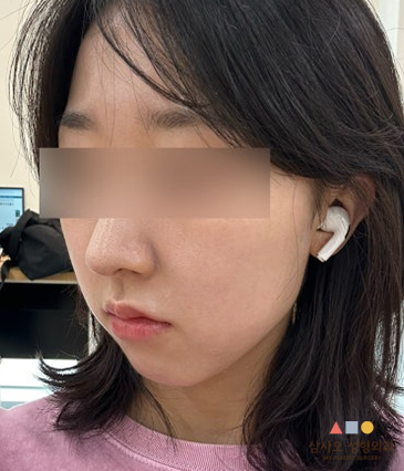 หลังทำหัตถการ